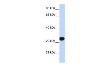 PDGFB Rabbit Polyclonal Antibody