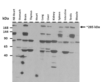 SPTAN1 Rabbit Polyclonal Antibody