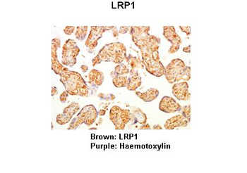 LRP1 Rabbit Polyclonal Antibody
