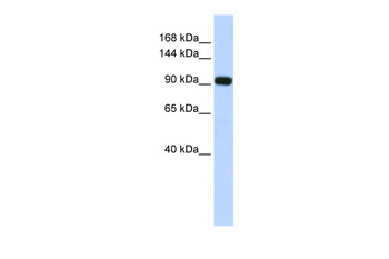 EVI1 Rabbit Polyclonal Antibody