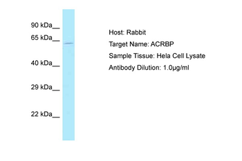 ACRBP Rabbit Polyclonal Antibody