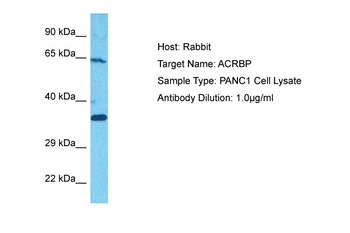 ACRBP Rabbit Polyclonal Antibody