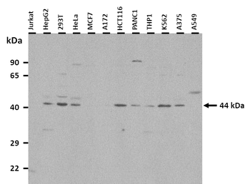 ATP6V1C1 Rabbit Polyclonal Antibody