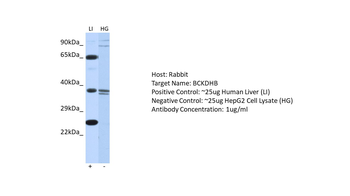 BCKDHB Rabbit Polyclonal Antibody