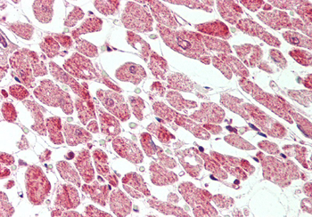 BECN1 Rabbit Polyclonal Antibody