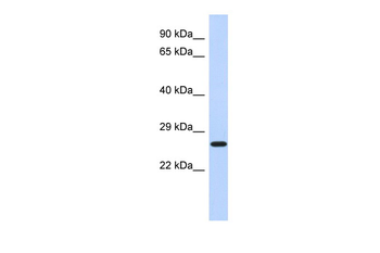 EFHD2 Rabbit Polyclonal Antibody