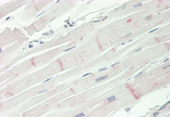 TRPC3 Rabbit Polyclonal Antibody