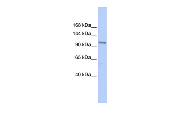 TRPC3 Rabbit Polyclonal Antibody