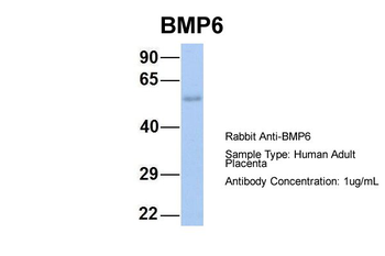 BMP6 Rabbit Polyclonal Antibody
