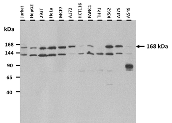 SLIT3 Rabbit Polyclonal Antibody
