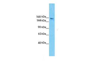 SLIT3 Rabbit Polyclonal Antibody