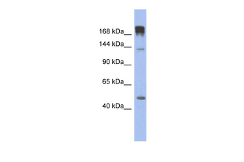 SLIT3 Rabbit Polyclonal Antibody