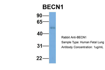 BECN1 Rabbit Polyclonal Antibody