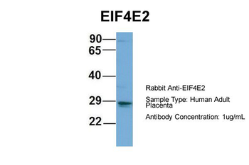 EIF4E2 Rabbit Polyclonal Antibody