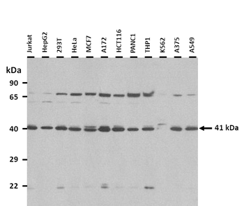 GNAI3 Rabbit Polyclonal Antibody