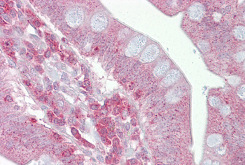 PSEN1 Rabbit Polyclonal Antibody