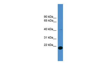 TMEM166 Rabbit Polyclonal Antibody