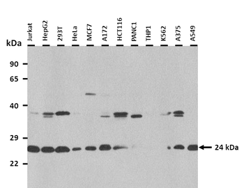 TP53INP2 Rabbit Polyclonal Antibody