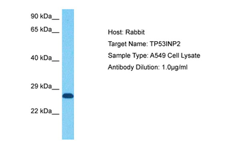 TP53INP2 Rabbit Polyclonal Antibody