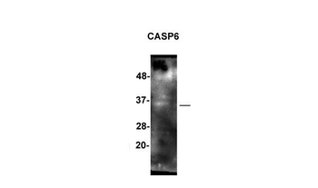 CASP6 Rabbit Polyclonal Antibody