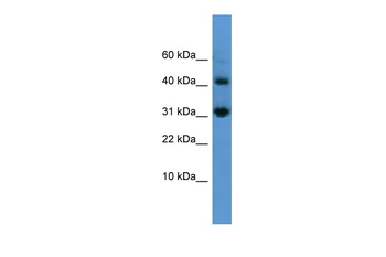 CASP7 Rabbit Polyclonal Antibody