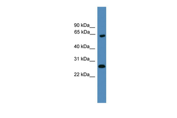 HMGB1 Rabbit Polyclonal Antibody