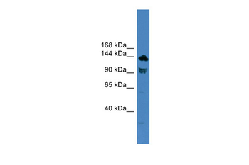TLR8 Rabbit Polyclonal Antibody