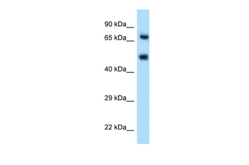 SELE Rabbit Polyclonal Antibody