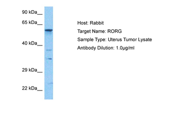RORG Rabbit Polyclonal Antibody