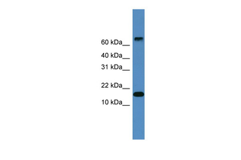 CST9 Rabbit Polyclonal Antibody
