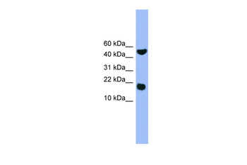 RWDD1 Rabbit Polyclonal Antibody