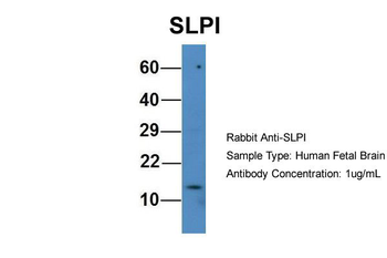 SLPI Rabbit Polyclonal Antibody