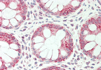 SPINT1 Rabbit Polyclonal Antibody