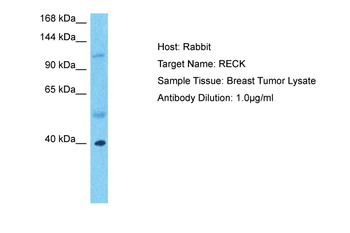 RECK Rabbit Polyclonal Antibody