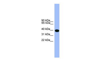 SERPINA1 Rabbit Polyclonal Antibody