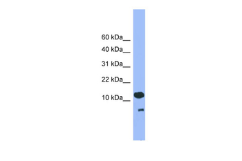 CDC26 Rabbit Polyclonal Antibody