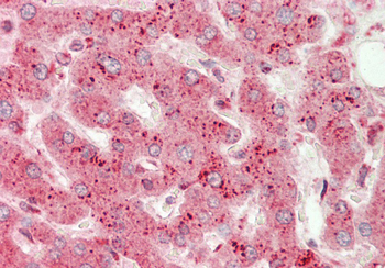 USP2 Rabbit Polyclonal Antibody