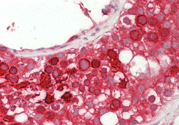 USP2 Rabbit Polyclonal Antibody