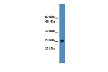 PSMD9 Rabbit Polyclonal Antibody