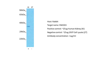 RWDD3 Rabbit Polyclonal Antibody