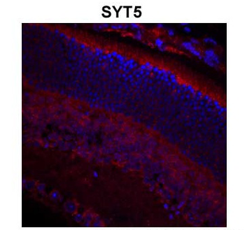 SYT5 Rabbit Polyclonal Antibody