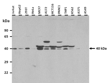 AVPR2 Rabbit Polyclonal Antibody