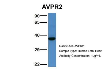 AVPR2 Rabbit Polyclonal Antibody