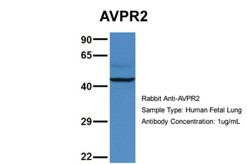 AVPR2 Rabbit Polyclonal Antibody