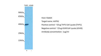 AVPR2 Rabbit Polyclonal Antibody