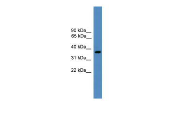 BSND Rabbit Polyclonal Antibody