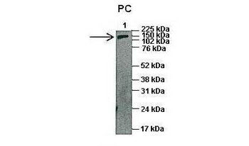 PC Rabbit Polyclonal Antibody