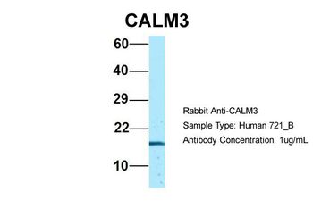 CALM3 Rabbit Polyclonal Antibody