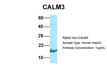 CALM3 Rabbit Polyclonal Antibody