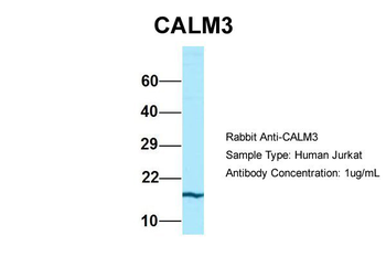 CALM3 Rabbit Polyclonal Antibody